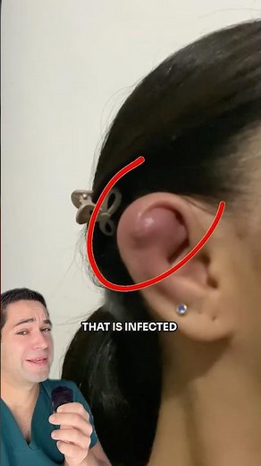 Why you should NEVER get this type of piercing