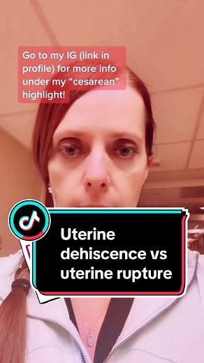 ✔️2 basic types of incisions used at cesarean deliveries (CDs): ➡️Low transverse (LTCD) •Most common •The option of a trial of labor after cesarean (TOLAC) in future pregnancies exists. ➡️Classical •Vertical (up and down) incision in the midportion of the uterus •Vaginal delivery is not recommended in future pregnancies. ➡️Other types: inverted T, J, transfundal, and low vertical. ✔️A classical incision is performed on the upper, thicker portion of the uterus. ➡️The chance of uterine rupture is