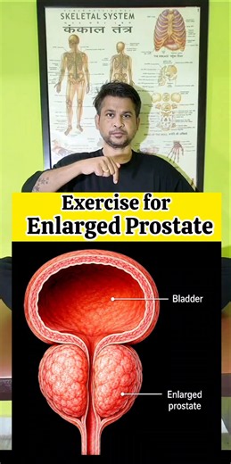 Exercise for Enlarged Prostate #exercise #wellness #motivation