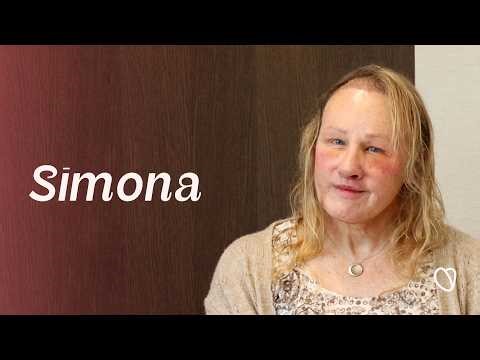 Having Facial Feminization Surgery at 60 | Simona, United Kingdom 🇬🇧 — #FFS Surgery Stories