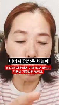 비타민c파우더&마데카솔연고#다음날 깜짝 놀라운 하얗게 되는 초강력효과/