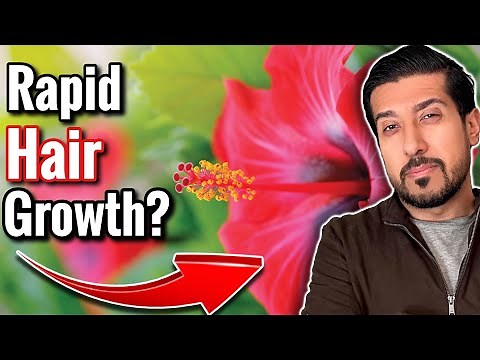 Hibiscus For Hair Growth REALLY WORKS | How to Use for Hibiscus for Hair