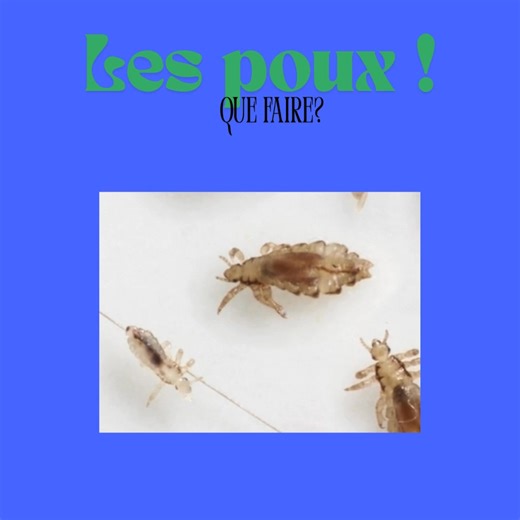 2.1K views | Le pou, c’est quoi? Les poux sont des parasites de...