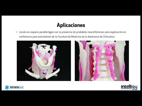 Bienvenida Procesamiento 3D de Imágenes Médicas con Mimics