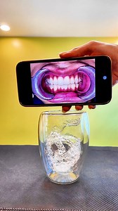 See the before. Imagine the after! ✨ What's in the glass? It’s your child’s journey to a brighter smile! 😁🦷 Scan. Align. Shine! Smile transformation made easy at Kidsmile—thanks to the power of clear aligners. ❤️ **Before and after photos are from an ongoing case, currently at 75% completion of treatment. #kidsmile #clearaligners #smiletransformation #KidsDentist #Pediatricdentistry | Kidsmile