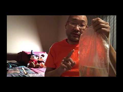 Peritoneal Dialysis (PD) Manuals (CAPD) At Home - Part 2 Dwell and Disconnecting | Kidney Journeys