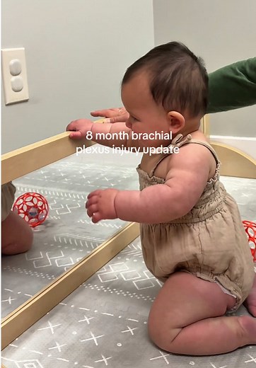 Understanding Brachial Plexus Injury in Infants