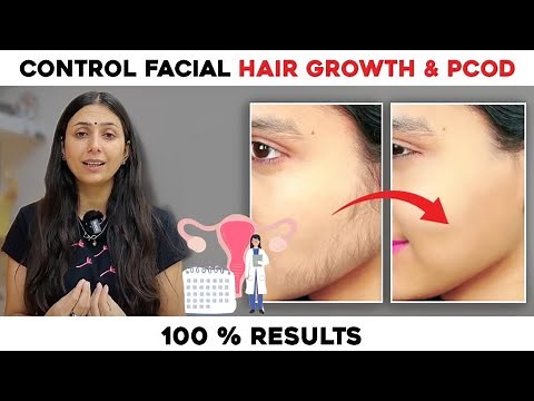 How to get rid of Facial Hair & PCOD : Expert Tips for Radiant Skin | Skin Care | UpasanakiDuniya