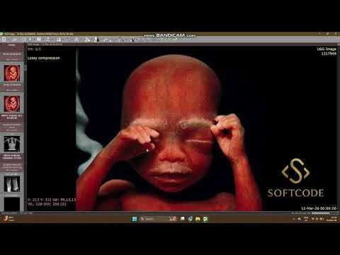 Radiant 2025.2 DICOM viewer lates version USG/ CT /MRI /Xray