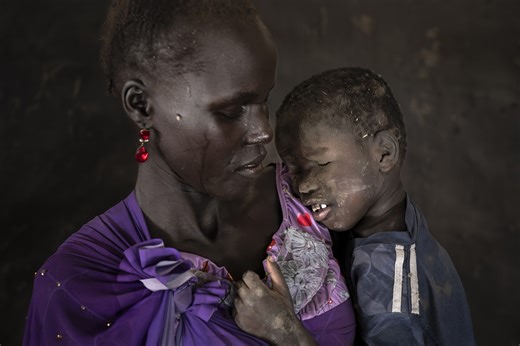 Severe Birth Defects Plague South Sudan’s Oil Fields