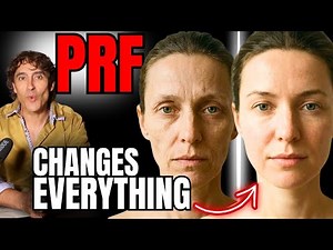 The Ultimate PRF Masterclass - Why It’s Transforming Aesthetics