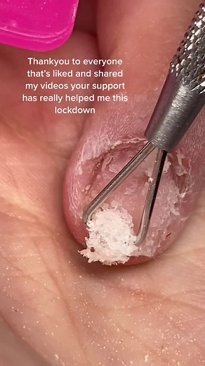 How to Safely Remove Acrylic Nails and Care for Your Cuticles