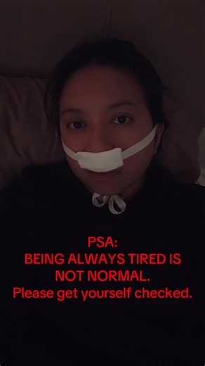 Understanding Sleep Apnea: My Journey and Treatment