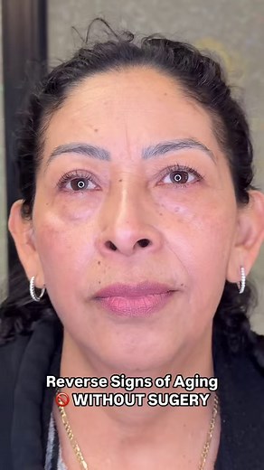 21K views · 25 reactions |  INKLESS STRETCH MARK TRAINING CLASSES...