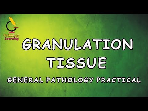 Granulation Tissue ( General Pathology Practical ) | Learning Pathology
