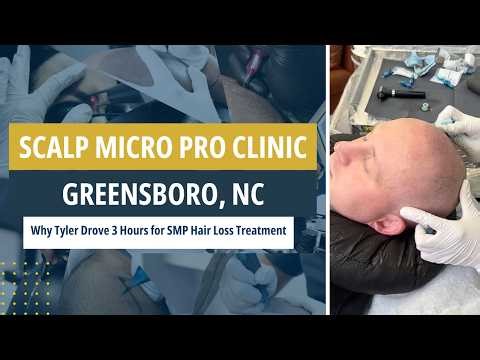 Why Tyler Drove 3 Hours for SMP Hair Loss Treatment | Scalp Micro Pro Clinic #hairloss #smplive #smp