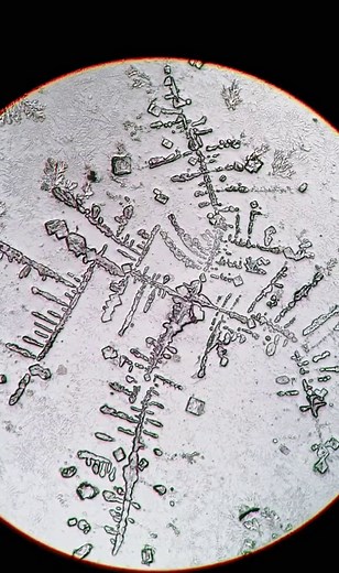 Sad Tears vs Happy Tears Under a Microscope | Emotional Differences Revealed
