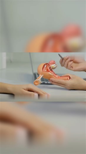 Scared of IUDs? Watch this video. Women Awareness #shorts #viral #trending