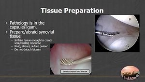 Multidirectional Instability: Does it Exist?