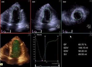 6.3K views · 230 reactions | Reduce the number of key strokes in your...