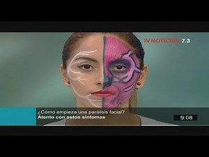 Everything you need to know about facial paralysis [TODAY IN HEALTH]