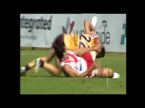 The Worst Broken Leg Ever!!