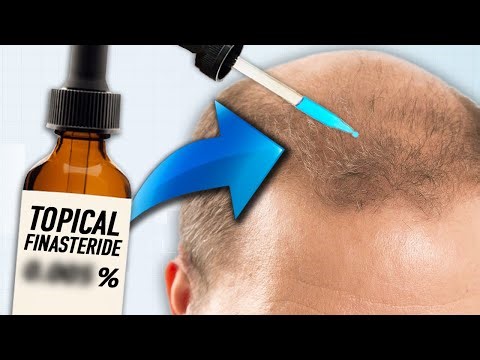 Low Dose Topical Finasteride: Better Results, Less Side Effects?!