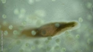 Worm Nemertea Lineus ruber under a microscope, family Lineidae.Climbed into someone's clutch of eggs to profit from embryos. White Sea