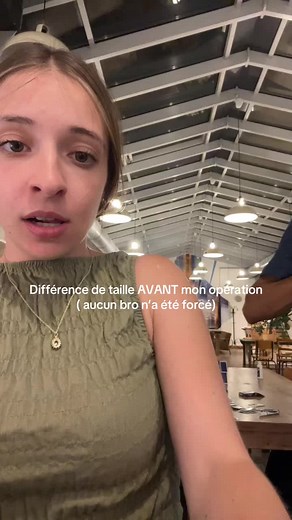 Différence de taille avant mon opération — réaction et story