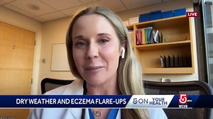 Dermatologist's tips for eczema flare-ups during dry weather