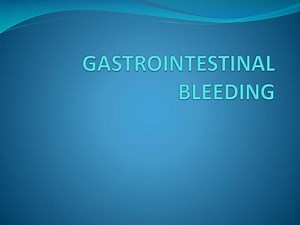 GASTROINTESTINAL BLEEDING - SlideServe