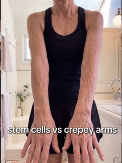 Stop hiding your arms! 🛑 Watch what happens to crepey skin in just 16 minutes. 🤯 The plant stem cells in StemuTone literally go to work in real-time to smooth, firm, and repair your skin barrier. Watch the side-by-side magic happen! It is time to ditch the cardigans and feel confident in short sleeves again. ✨ Tap the link in our bio or head to www.StemuTone.com to get yours! 🛍️ #crepeyskin #skintok #over50tiktok #plantstemcells #antiagingbodycare