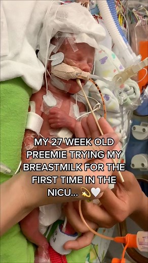 My 27 Week Premature Baby Having my Breast Milk for the First Time... 🫶🏻 | Rachel Renee Hughes