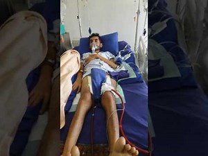 ECMO (Extracorporeal life support ) on awake patient waiting for heart transplant