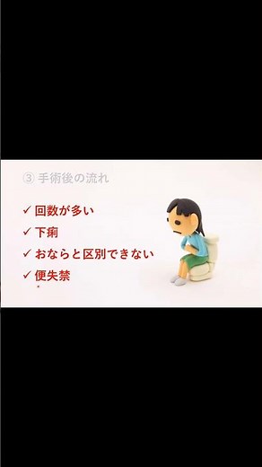 作る前に知っておいて★人工肛門閉鎖手術の方法とは【医師解説】⑨