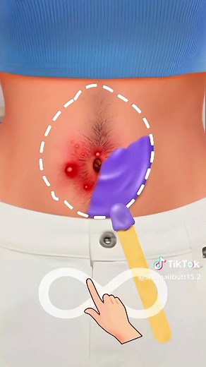 Extreme Belly Button Cleaning ASMR Animation 4K
