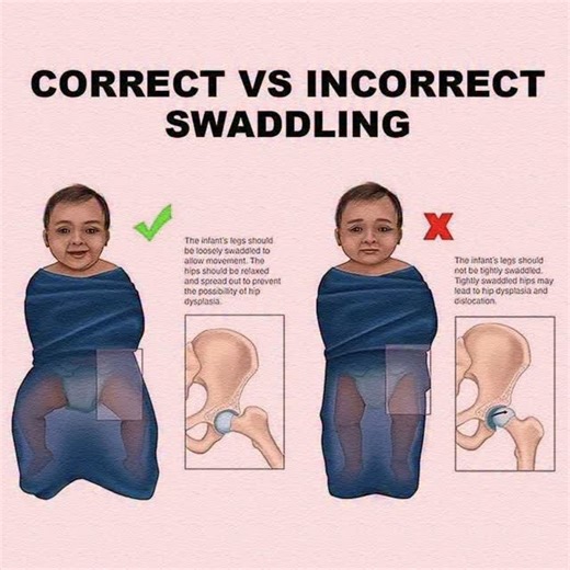 🍼 Benefits of Swaddling Your Baby 🤍 Swaddling isn’t just cute — it’s comforting! Here’s why: 🤱 Mimics the womb – Helps baby feel safe and secure 😴 Improves sleep – Reduces startle reflex that wakes them up 🧘‍♀️ Soothes fussiness – Calms crying and overstimulation 🌡️ Keeps baby warm – Regulates body temperature 💤 Encourages longer naps – More rest for baby (and you!) Tip: Always place baby on their back and don’t swaddle too tight! #SwaddlingBenefits #NewbornCare #BabyTips #MomLife #Parent