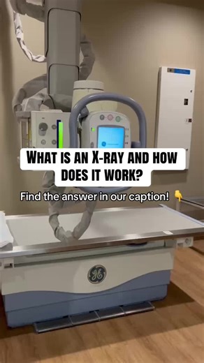 Understanding X-rays: Quick Insights into Radiology