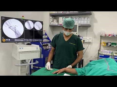K-wire Removal Procedure by Dr.Nikhil Phade ( Orthopaedic Surgeon ) THE HEALING JOINT