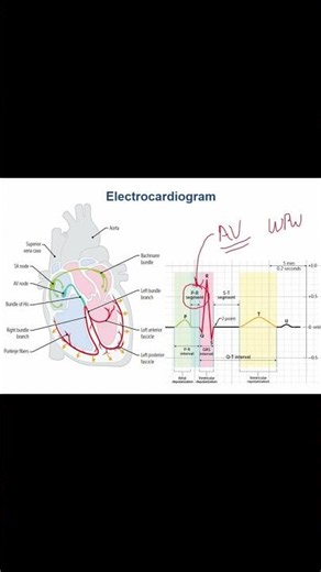 ECG Basics Decoding Your Heart's Electrical Signals