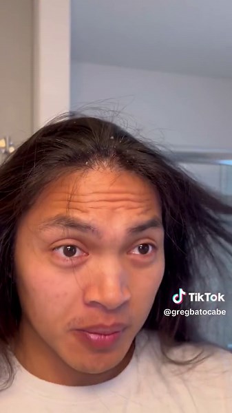 more scalp scraping #psoriasis #psoriasisawareness #flakes #dandruff #hair #haircare #longhair #seborrheicdermatitis