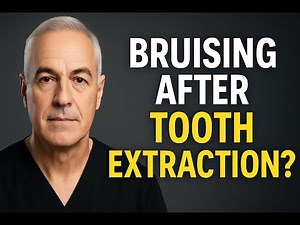 Bruising After Tooth Extraction: What’s Normal and When to Call Your Dentist