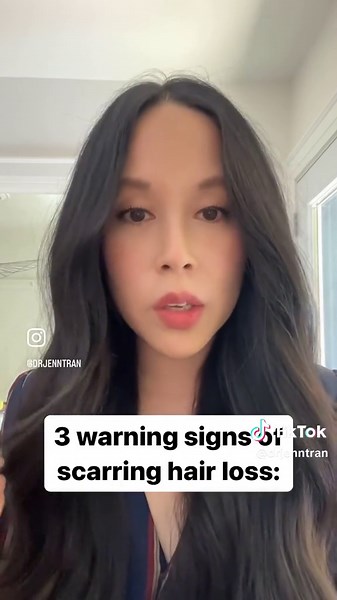 Identifying Scarring Hair Loss: 3 Warning Signs
