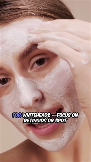 👩‍⚕️ Blackheads vs Whiteheads — Dermatologists’ Fix ✨ #skincare
