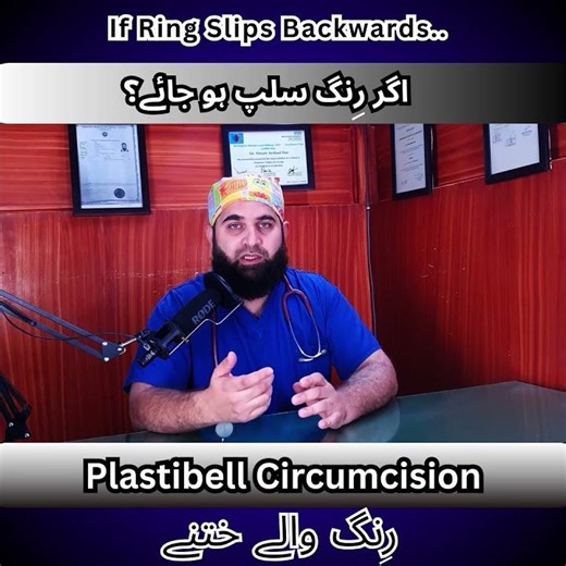 Agr Ring slip ho jaye tu kia kary?💍🤔