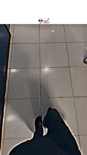 Experiencing the Operating Theater: A Journey Inside