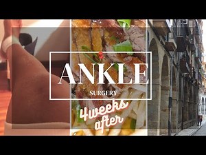 ANKLE SURGERY: How's the recovery after 4 weeks? #orif #brokenbone #anklesurgery