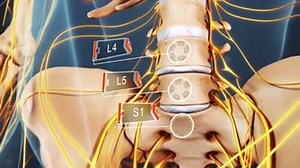24K views · 554 reactions | The vast majority of sciatica symptoms...