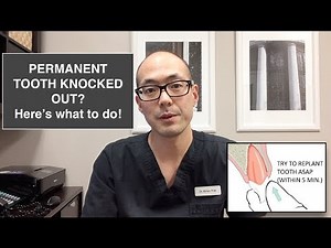 PERMANENT TOOTH KNOCKED OUT? Here's What To Do!