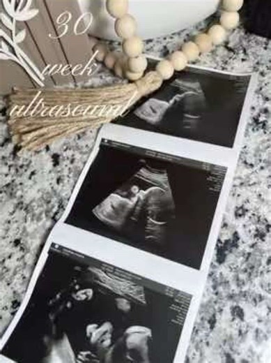 30 Weeks Pregnant: A Heartwarming Ultrasound Wave